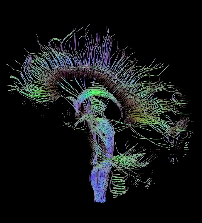 Pasos básicos en Resonancia Magnética