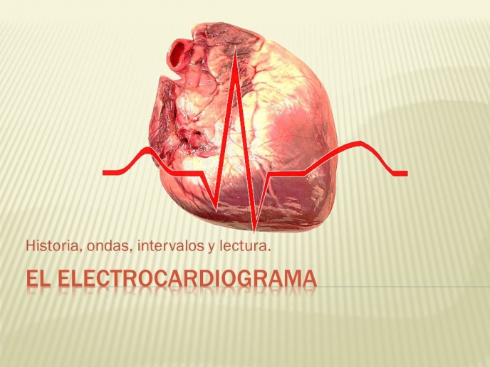 Electrocardiografía y determinación de ejes